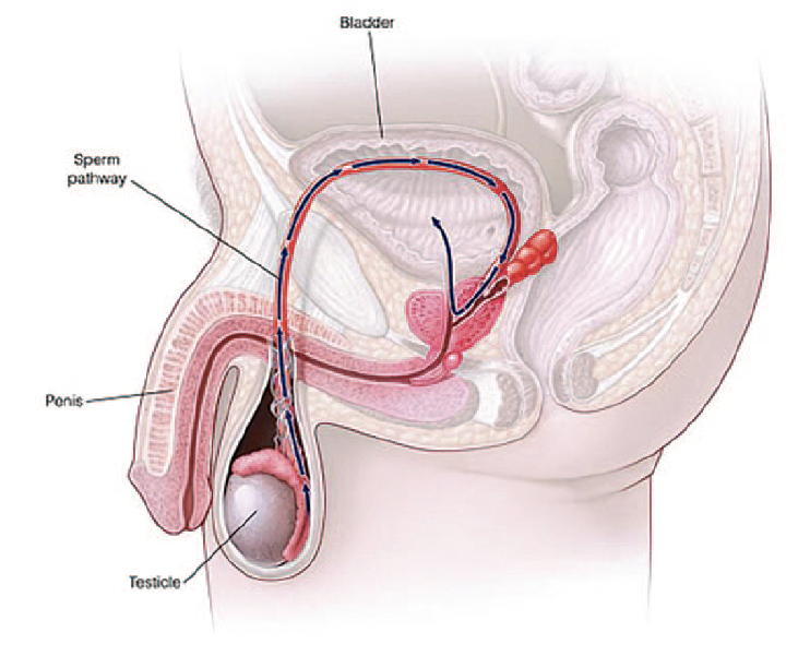 анэякуляция